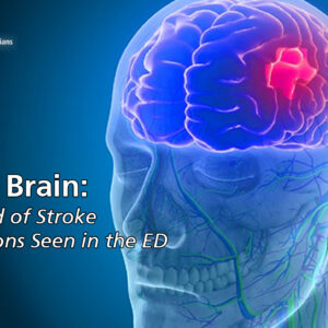 Time is Brain: The Myriad of Stroke Presentations Seen in the ED Course –  ACEP Members - Illinois College of Emergency Physicians